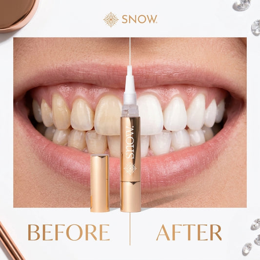SNOW Extra Strength Teeth Whitening Pen